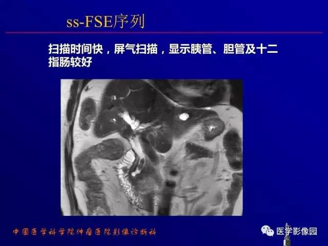 【PPT】胰腺及胆道肿瘤的CT、MRI诊断思路