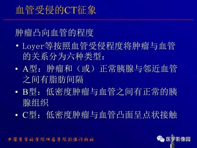 【PPT】胰腺及胆道肿瘤的CT、MRI诊断思路