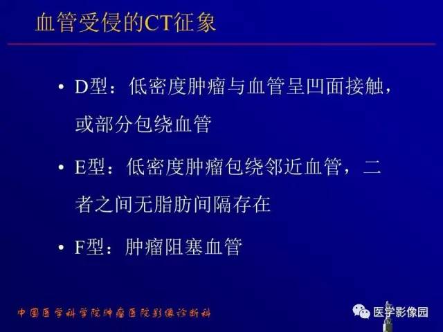 【PPT】胰腺及胆道肿瘤的CT、MRI诊断思路