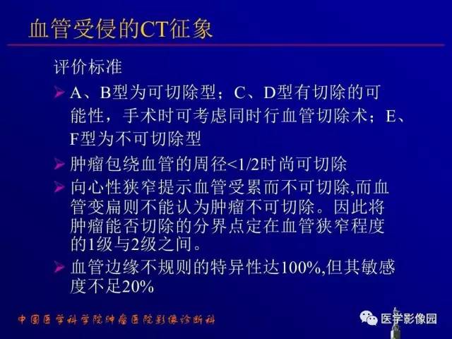 【PPT】胰腺及胆道肿瘤的CT、MRI诊断思路