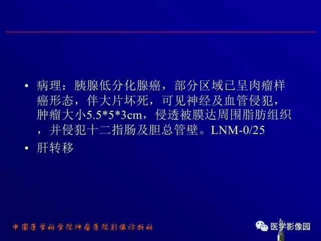 【PPT】胰腺及胆道肿瘤的CT、MRI诊断思路