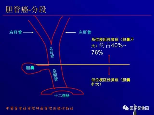 【PPT】胰腺及胆道肿瘤的CT、MRI诊断思路