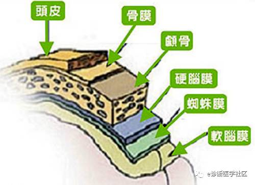 15种亚型脑膜瘤影像表现及诊断要点 15种亚型脑膜瘤影像表现及诊断要点