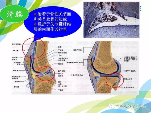 【PPT】骨肌系统影像学基本征象再认识