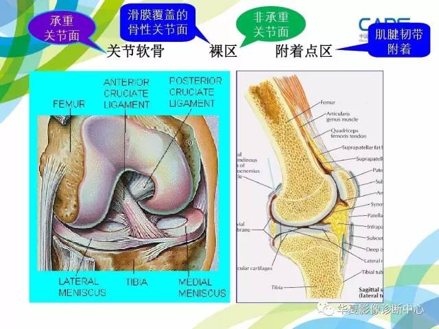 【PPT】骨肌系统影像学基本征象再认识
