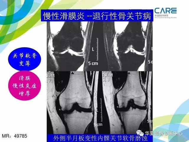 【PPT】骨肌系统影像学基本征象再认识