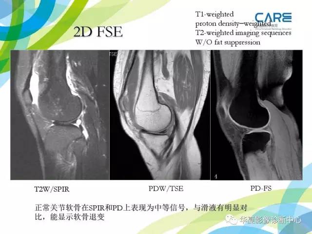 【PPT】骨肌系统影像学基本征象再认识