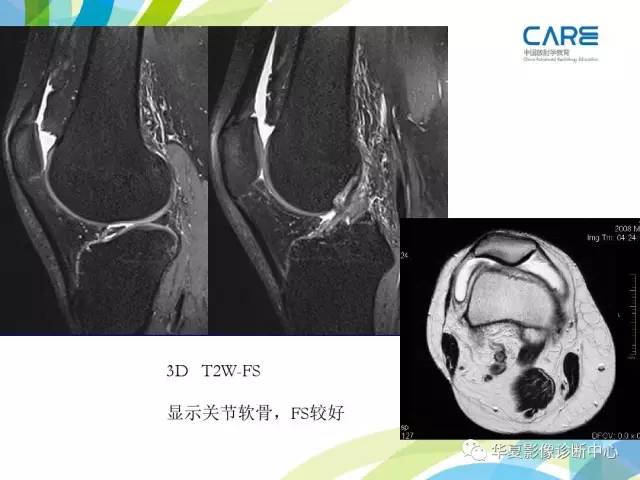 【PPT】骨肌系统影像学基本征象再认识