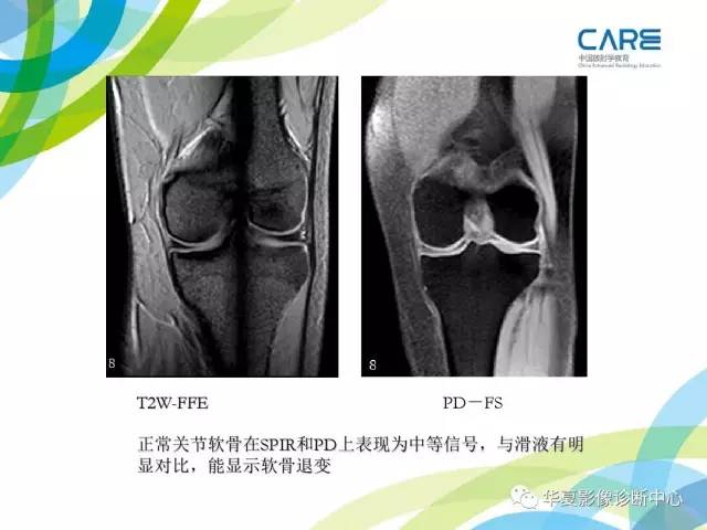 【PPT】骨肌系统影像学基本征象再认识