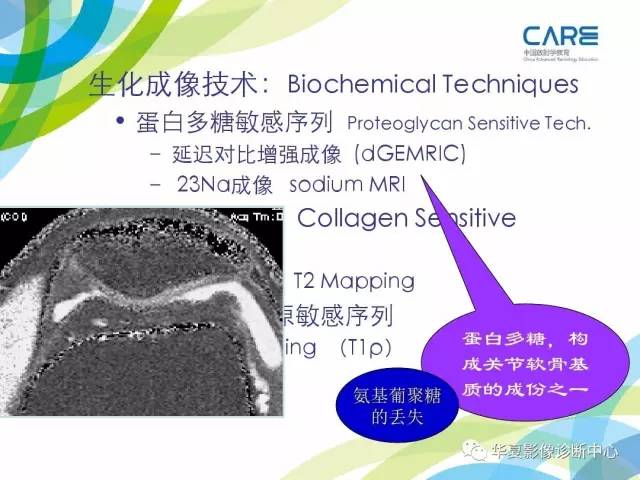 【PPT】骨肌系统影像学基本征象再认识