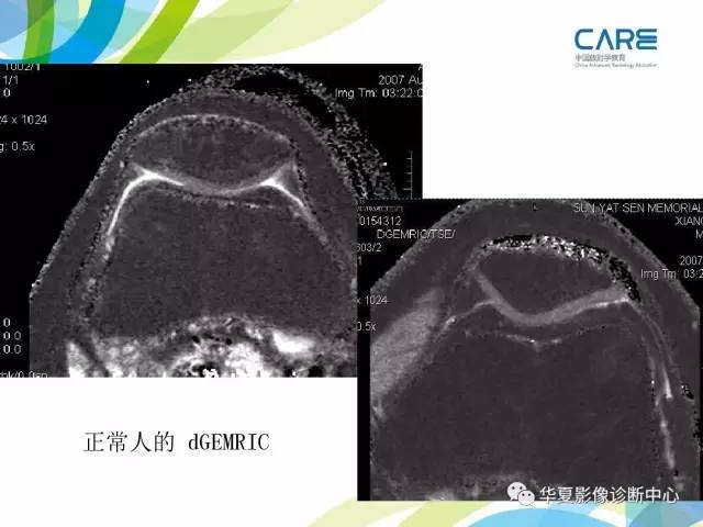 【PPT】骨肌系统影像学基本征象再认识