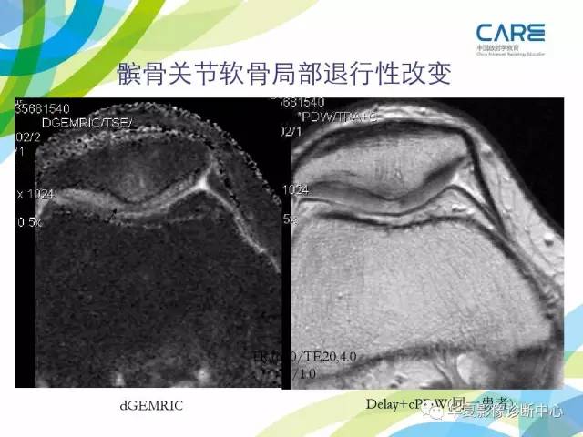 【PPT】骨肌系统影像学基本征象再认识
