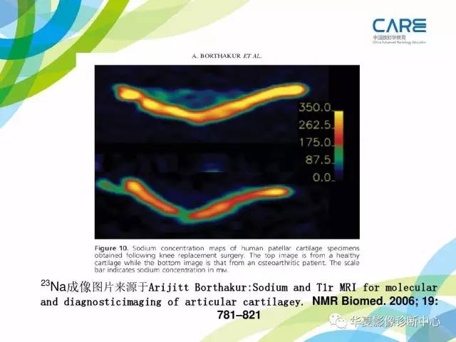 【PPT】骨肌系统影像学基本征象再认识