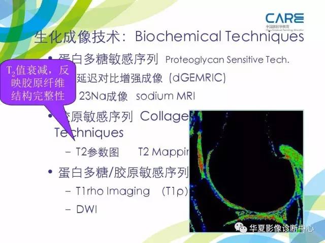 【PPT】骨肌系统影像学基本征象再认识