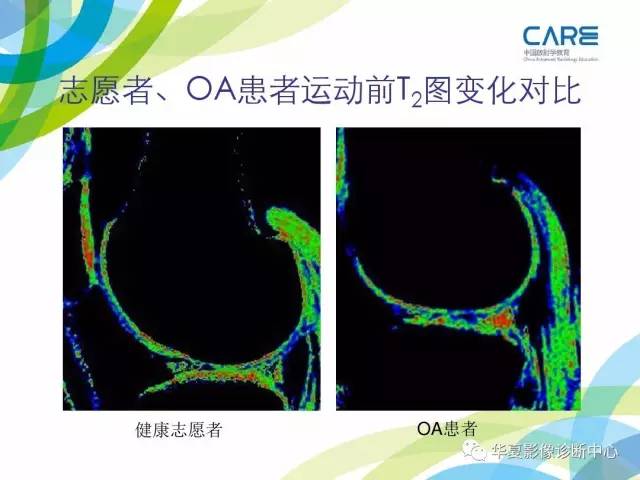 【PPT】骨肌系统影像学基本征象再认识