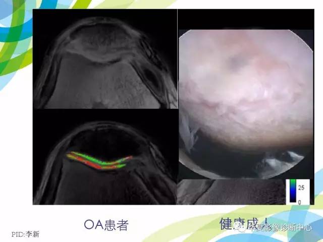 【PPT】骨肌系统影像学基本征象再认识