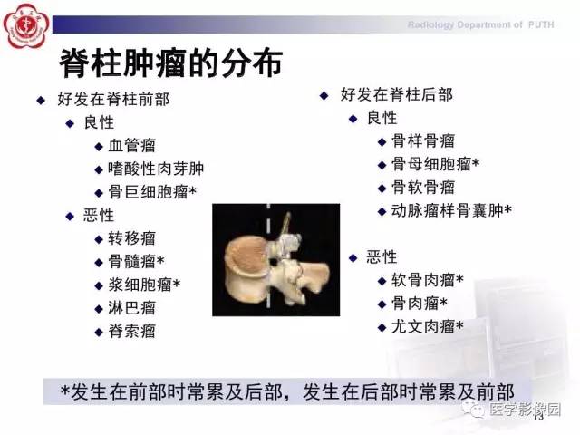 【PPT】脊柱肿瘤影像诊断思路