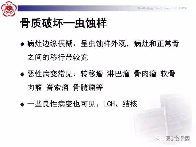 【PPT】脊柱肿瘤影像诊断思路