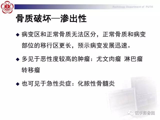 【PPT】脊柱肿瘤影像诊断思路