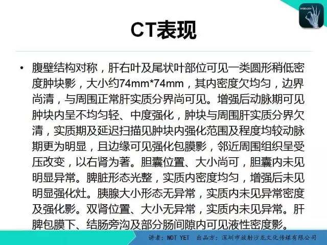【病例】肝母细胞瘤1例CT影像表现