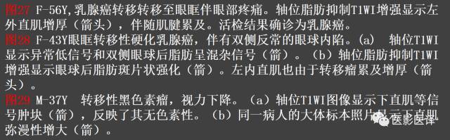 成人眼眶肿瘤:临床、影像、与病理回顾 成人眼眶肿瘤:临床、影像、与病理回顾