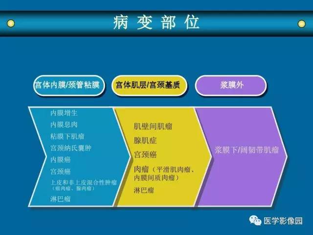 【PPT】女性盆腔肿瘤的MR成像技术与诊断思路