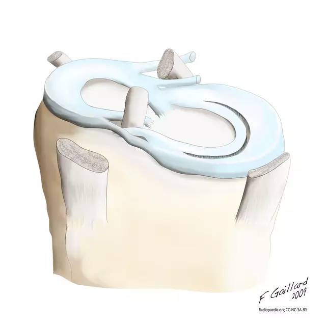 典型征象分析之双后交叉韧带征 典型征象分析之双后交叉韧带征