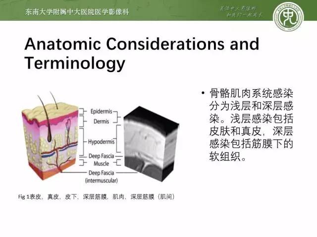 【PPT】软组织感染的影像学表现：从蜂窝织炎到坏死性筋膜炎