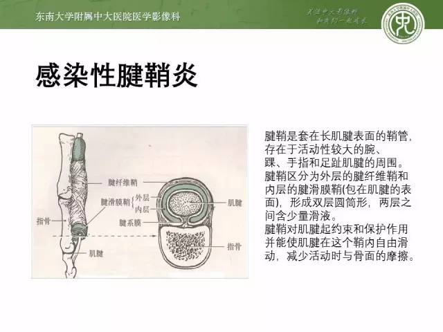 【PPT】软组织感染的影像学表现：从蜂窝织炎到坏死性筋膜炎