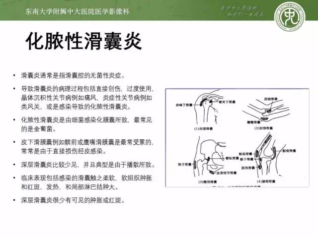 【PPT】软组织感染的影像学表现：从蜂窝织炎到坏死性筋膜炎