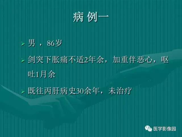 【病例】不典型肝癌2例CT及MR影像表现
