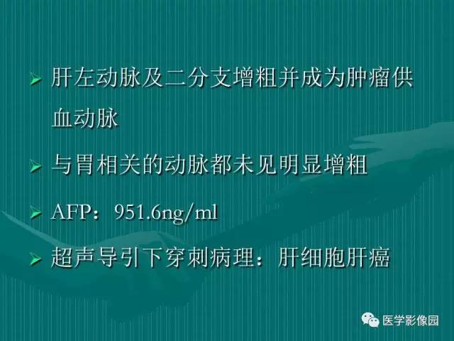 【病例】不典型肝癌2例CT及MR影像表现