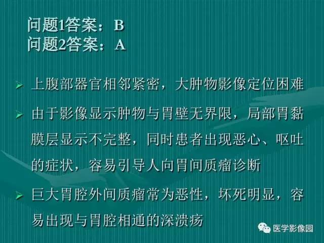 【病例】不典型肝癌2例CT及MR影像表现
