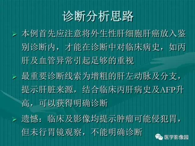 【病例】不典型肝癌2例CT及MR影像表现