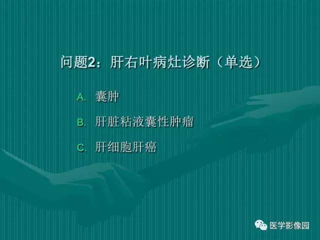 【病例】不典型肝癌2例CT及MR影像表现