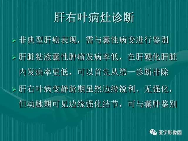 【病例】不典型肝癌2例CT及MR影像表现