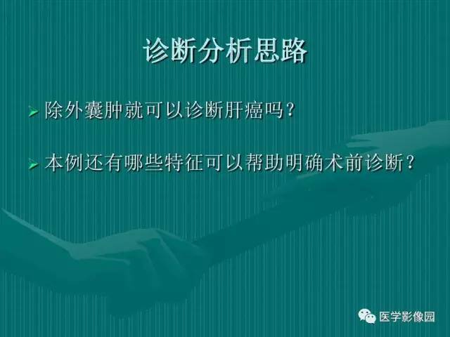 【病例】不典型肝癌2例CT及MR影像表现