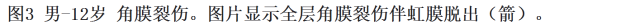 眼球外伤：影像医生阅片必须注意的地方