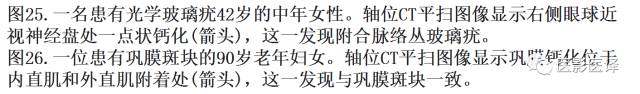 眼球外伤:影像医生阅片必须注意的地方 眼球外伤:影像医生阅片必须注意的地方