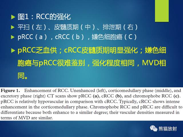 【PPT】乳头状肾细胞癌--影像病理相关性