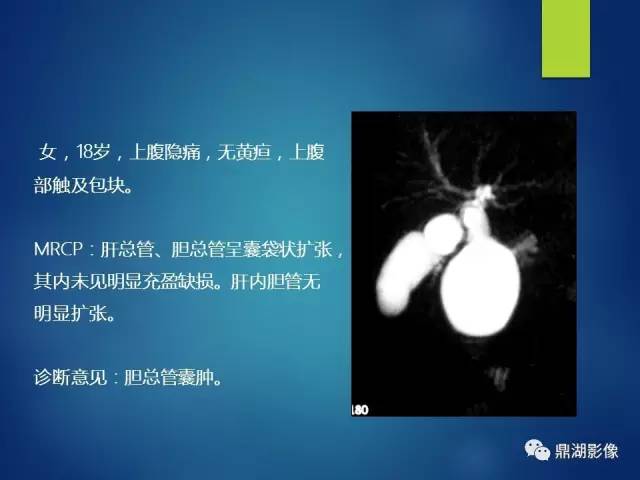 【PPT】MRCP在胆道系统疾病中的诊断价值