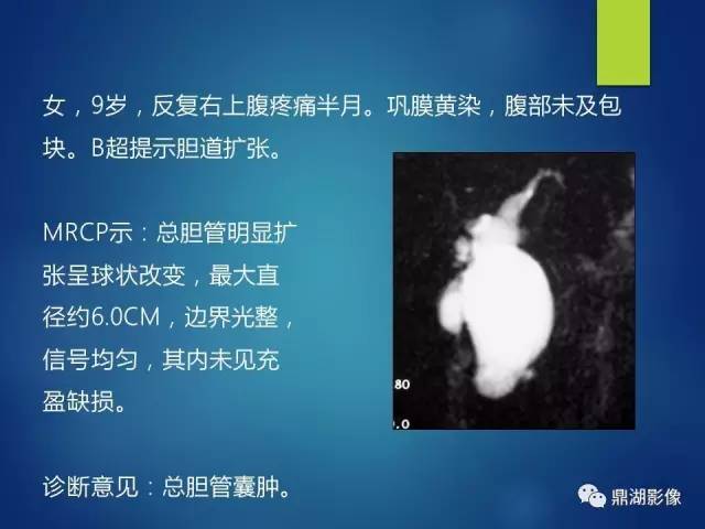 【PPT】MRCP在胆道系统疾病中的诊断价值