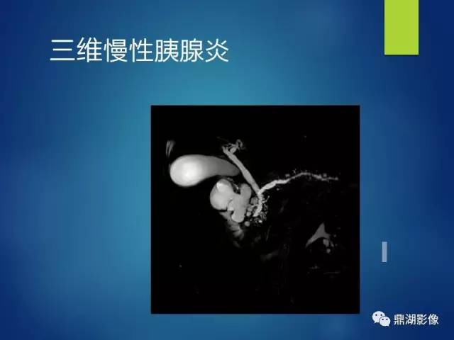 【PPT】MRCP在胆道系统疾病中的诊断价值
