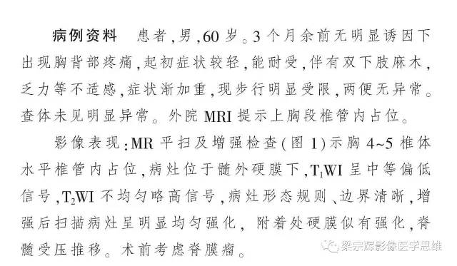 【病例】椎管内孤立性纤维瘤1例MR影像诊断思路
