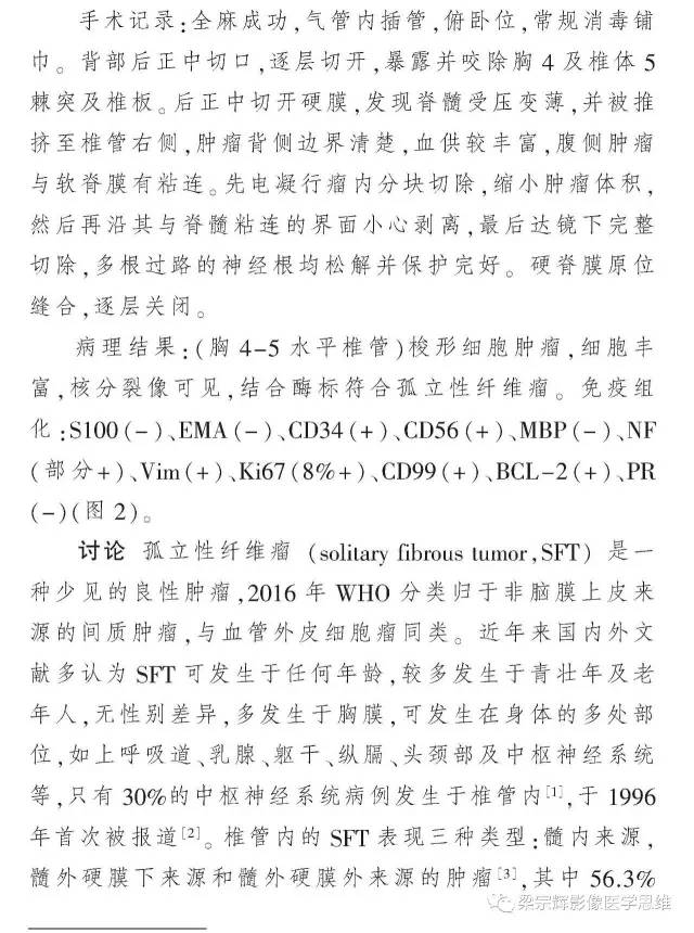 【病例】椎管内孤立性纤维瘤1例MR影像诊断思路