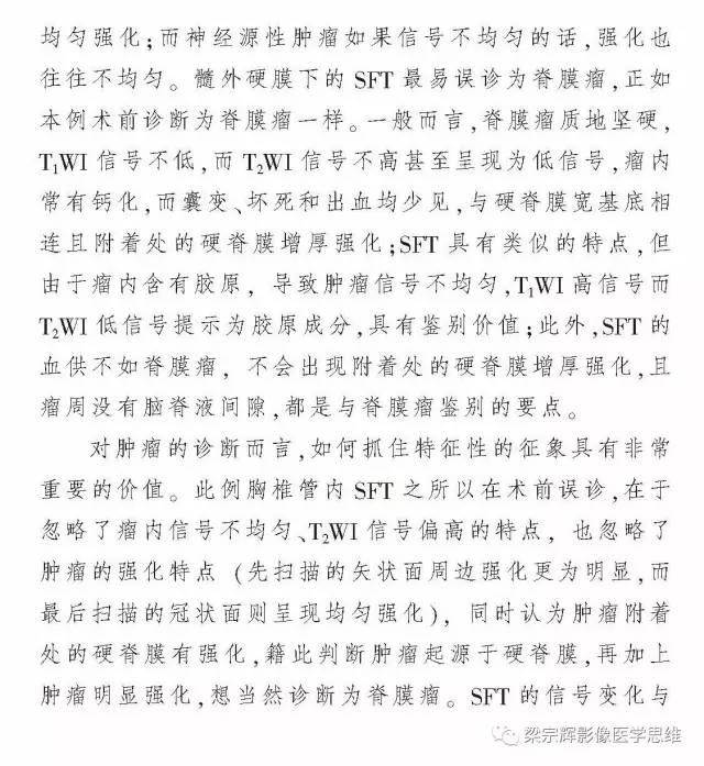 【病例】椎管内孤立性纤维瘤1例MR影像诊断思路