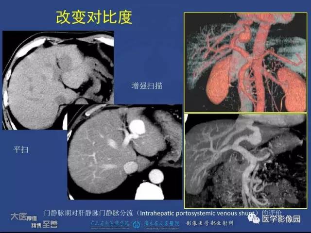【PPT】对比剂安全与规范使用
