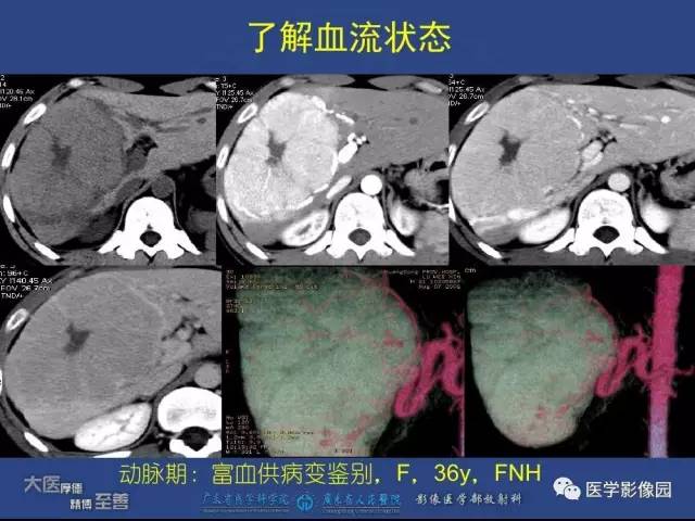 【PPT】对比剂安全与规范使用