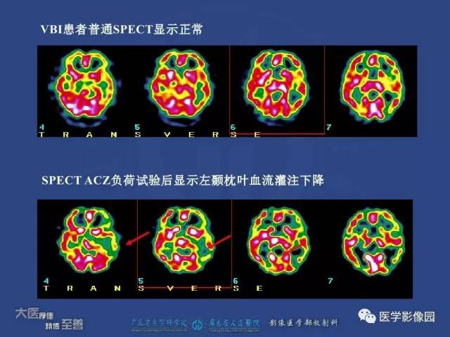 【PPT】对比剂安全与规范使用