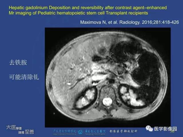 【PPT】对比剂安全与规范使用